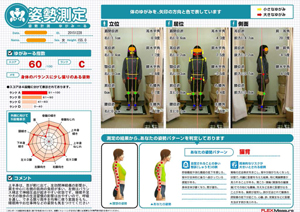 肩を中心に右側の筋肉の負担が多い。