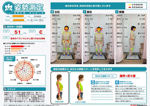 身体の「ゆがみ」検査結果レポート