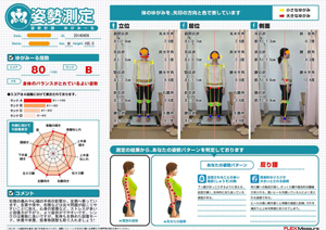 身体の「ゆがみ」検査結果レポート