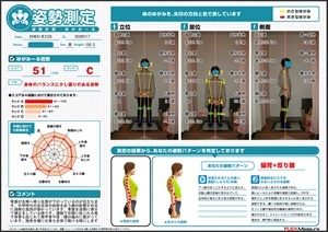 左肩が下がり骨盤が左側へ