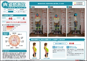 後頭骨に負担が掛かっている