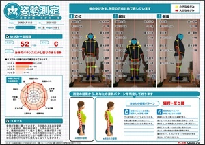 骨盤が左側に寄っている。