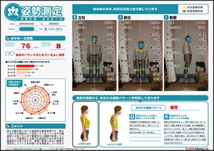 典型的な猫背姿勢
