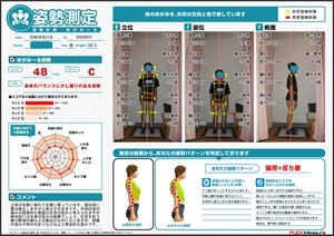直接的な要因は左首の歪みですが…