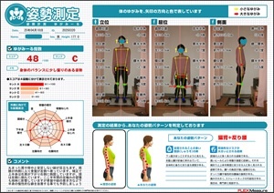 両膝が内側に入り骨盤が左側へ