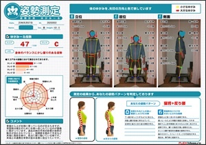 補正のために逆側へ捻じれている