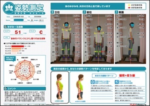 脚の外側の筋肉で代償