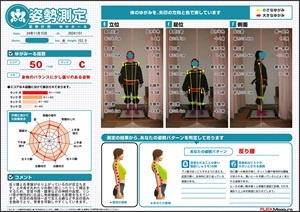 反り腰と右骨盤のせり上がり