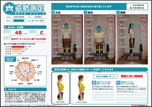 反り腰と捻じれが目立つ