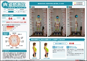 補正で首の右側に負担が掛かり