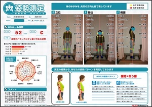 反り腰と前首が目立ちますが…