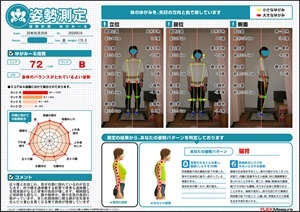 肘や膝を過伸展する癖