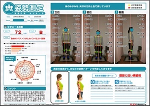 背骨が捻じれて慢性的に固まっている