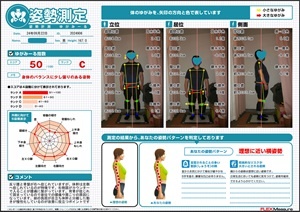 体幹と脚が分離した動き