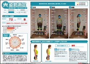 腰仙関節が捻じれてしまうと…