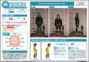 近年の股関節や殿筋の拘縮