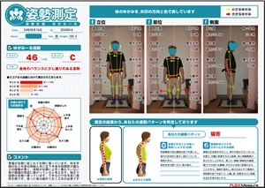 骨盤から右側に寄っています